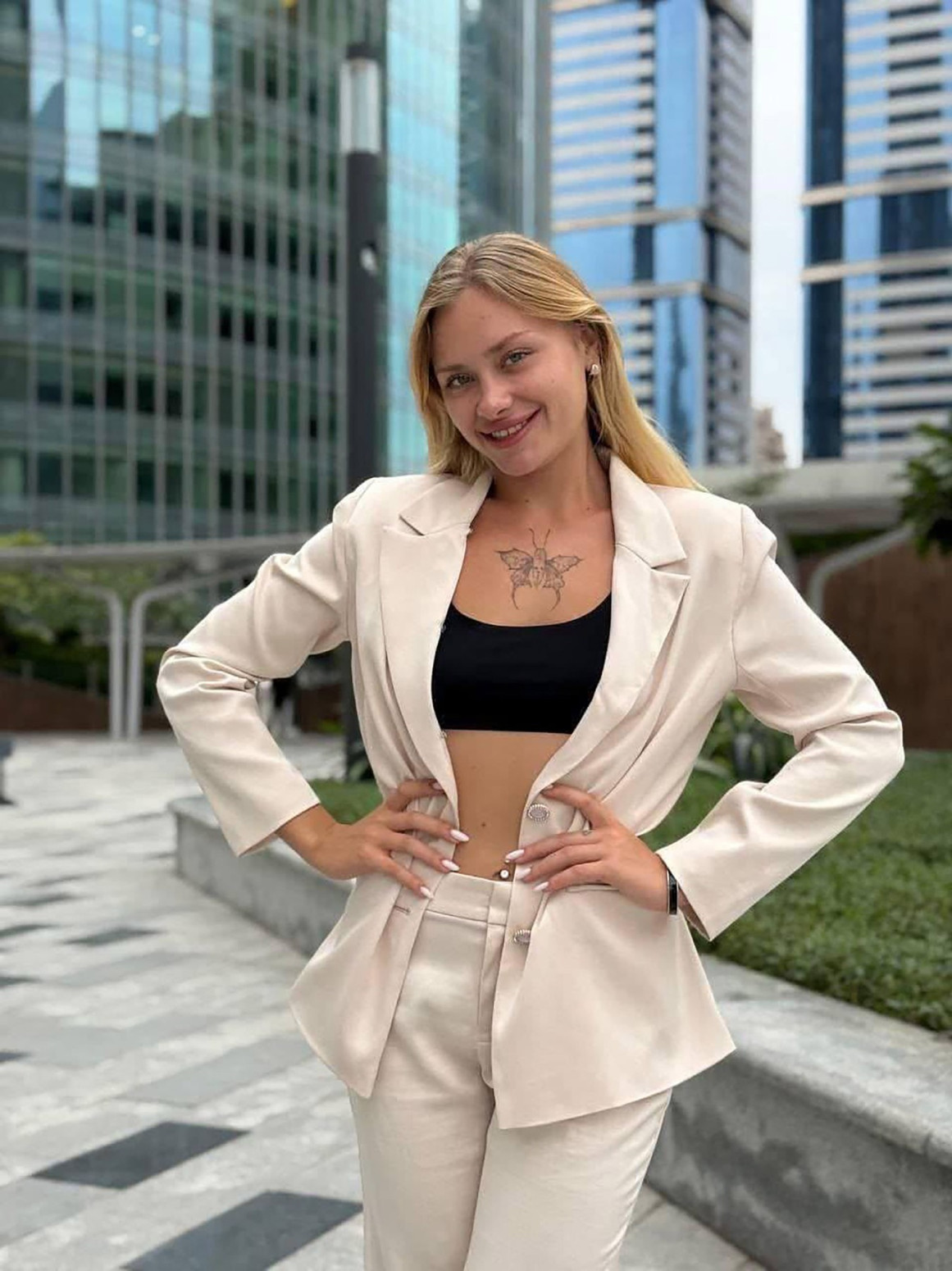 Zvezdi OnlyFansa kojoj je slomljena kičma u Dubaiju stiže tužba FOTO