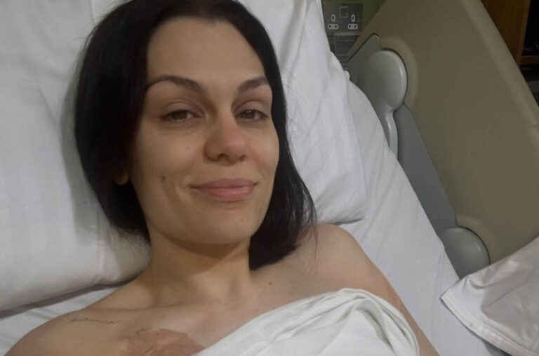 Džesi Džej mora na još jednu operaciju karcinoma dojke: „Osećam se frustrirano i tužno“