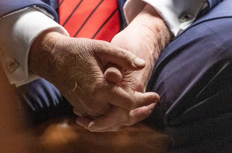 Donalde, šta kriješ? „Za to ti ne trebaju flasteri“ FOTO