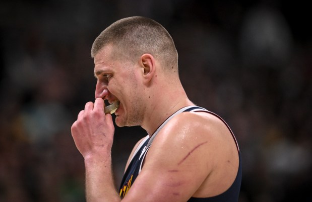 Sijeku li Amerikanci nokte prije utakmice?: Gadne rane na Jokićevim bicepsima FOTO