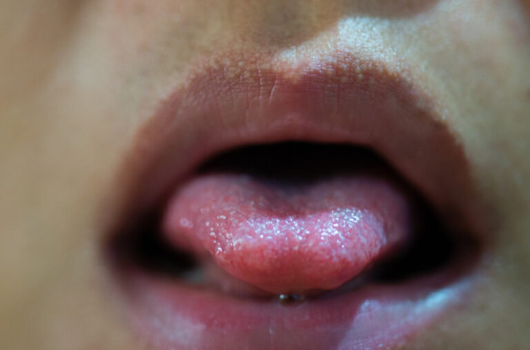 Poznatoj influenserki posle jednog poljupca pukao jezika na dva dijela: Završila u bolnici posle sastanka